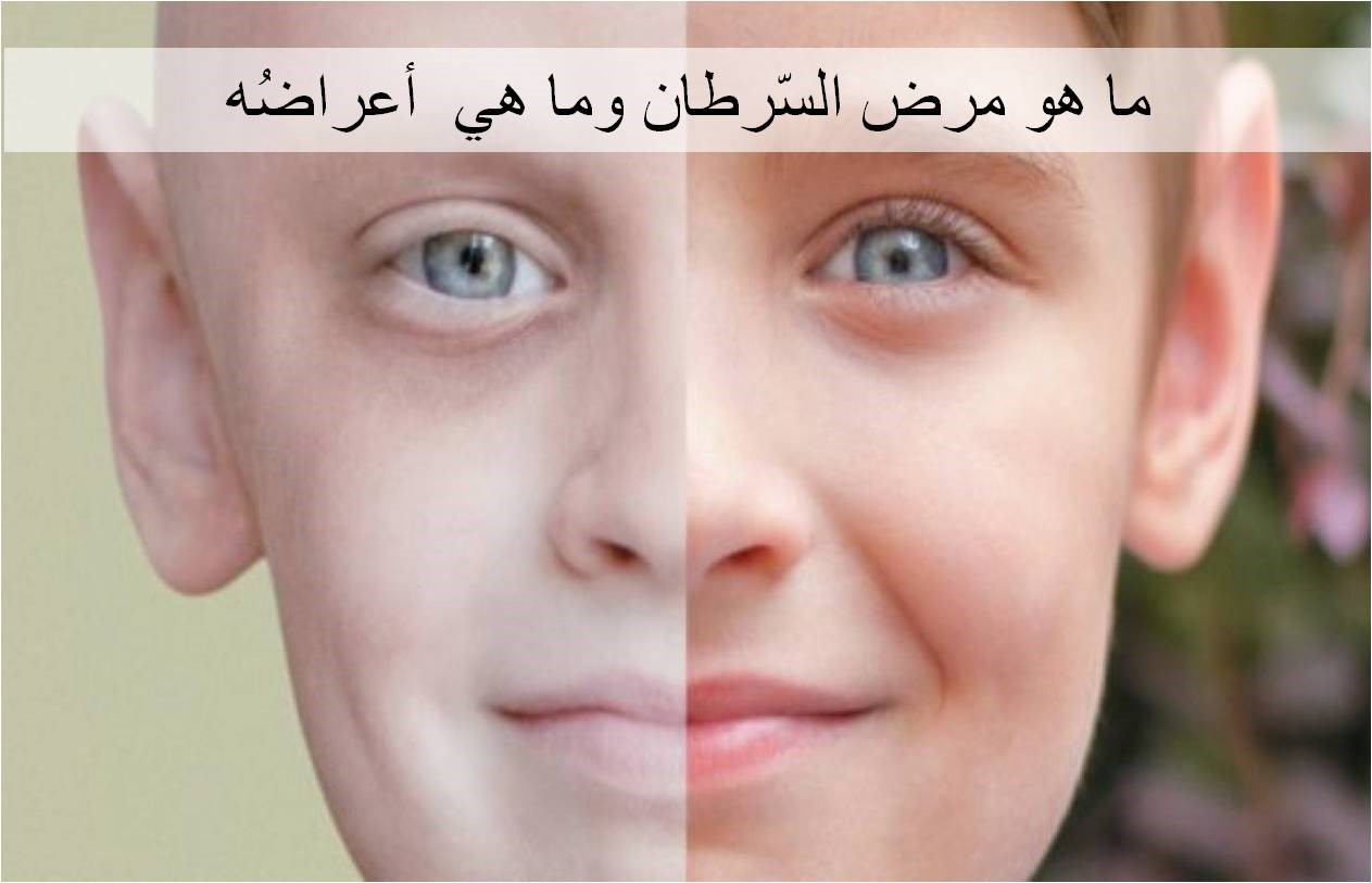 ما هو مرض السّرطان وما هي أعراضُه