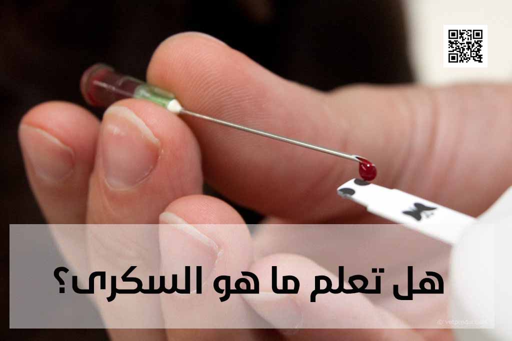 هل تعلم ما هو السكرى؟ - الصحة والجمال